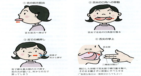 舌のトレーニング